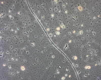 Cable bacteria under a microscope